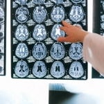 Нейропсихология игровых решений и работа мозга при принятии решений